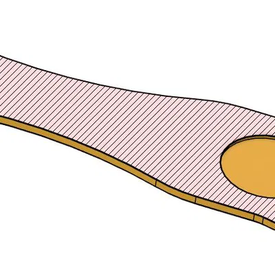 Mở Bia Gắn Đồng 5 Cent