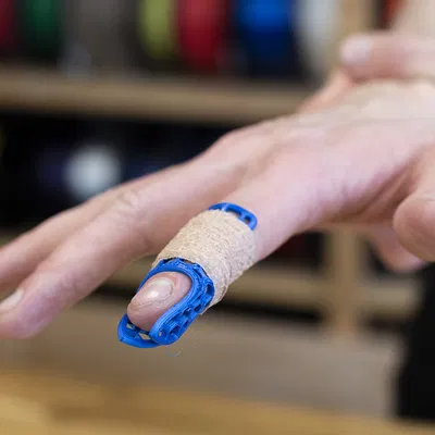 Băng đeo ngón tay (nẹp)