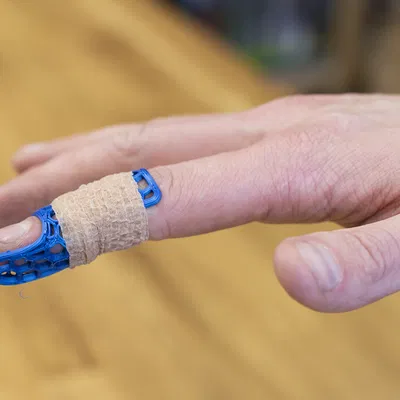 Băng đeo ngón tay (nẹp)