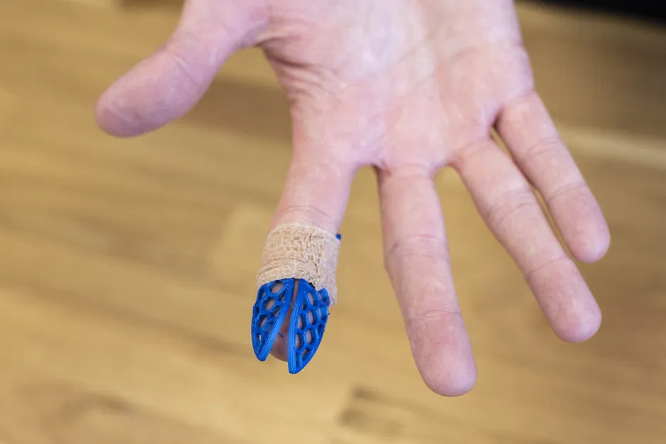 Băng đeo ngón tay (nẹp) - Image 4