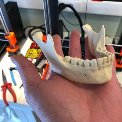 Hộp sọ người, đúng giải phẫu