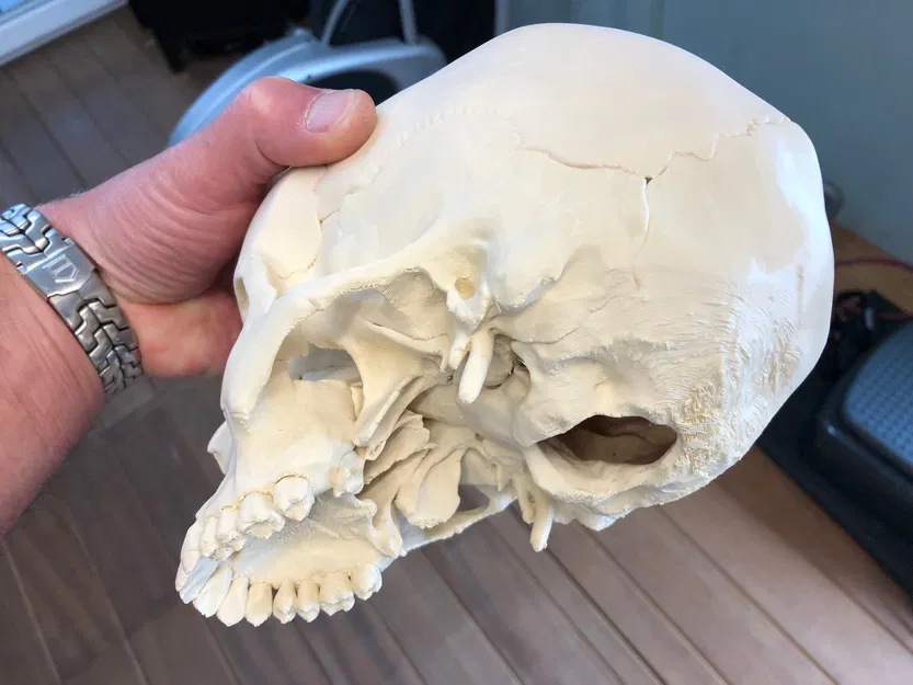 Hộp sọ người, đúng giải phẫu - Image 7