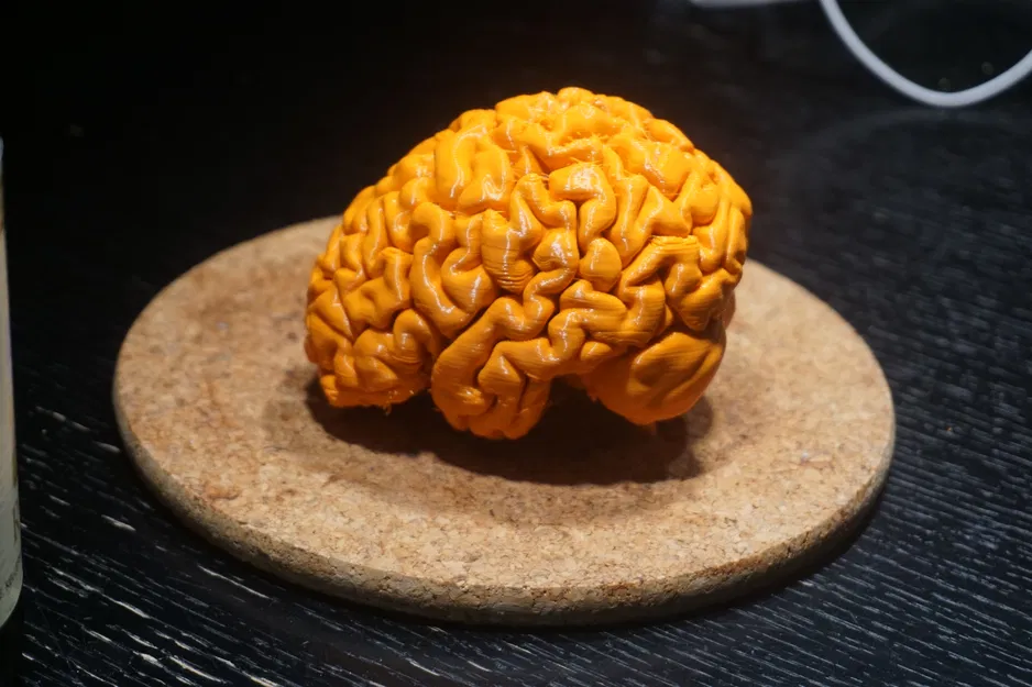 Mô hình bộ não người từ ảnh MRI đẹp - Image 4