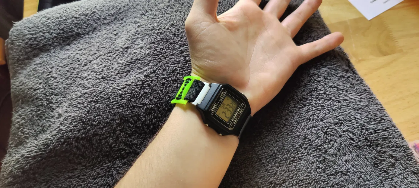 Kẹp Dây Đồng Hồ NFC Wag - Image 4