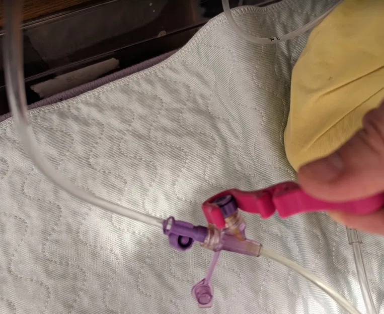 Dụng Cụ Mở Enfit Cao Cấp - Image 3