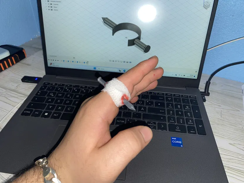 Móng Tay Xuyên Ngón Tay - Image 1