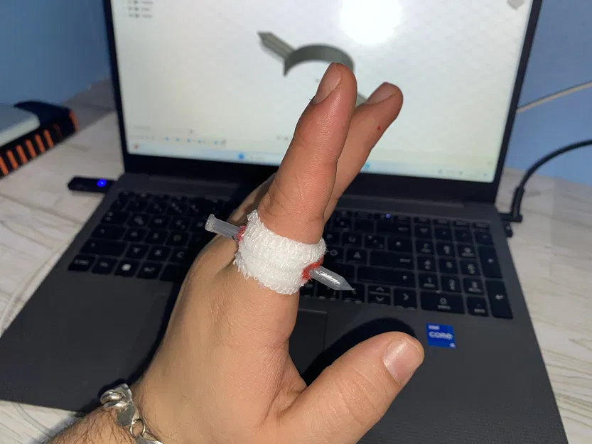 Móng Tay Xuyên Ngón Tay - Image 2