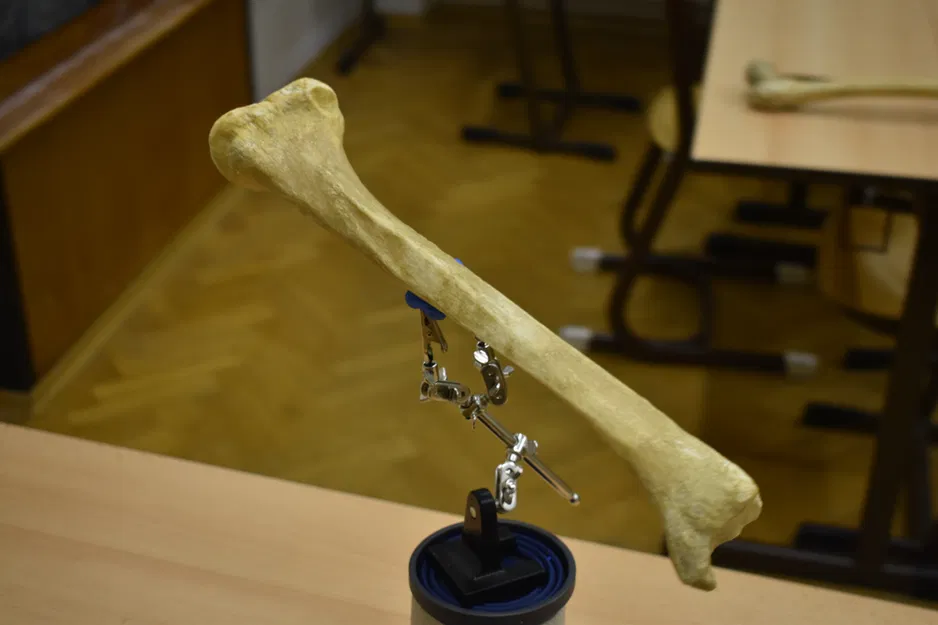 Xương chày - Shinbone Scan - Tibia - Image 2