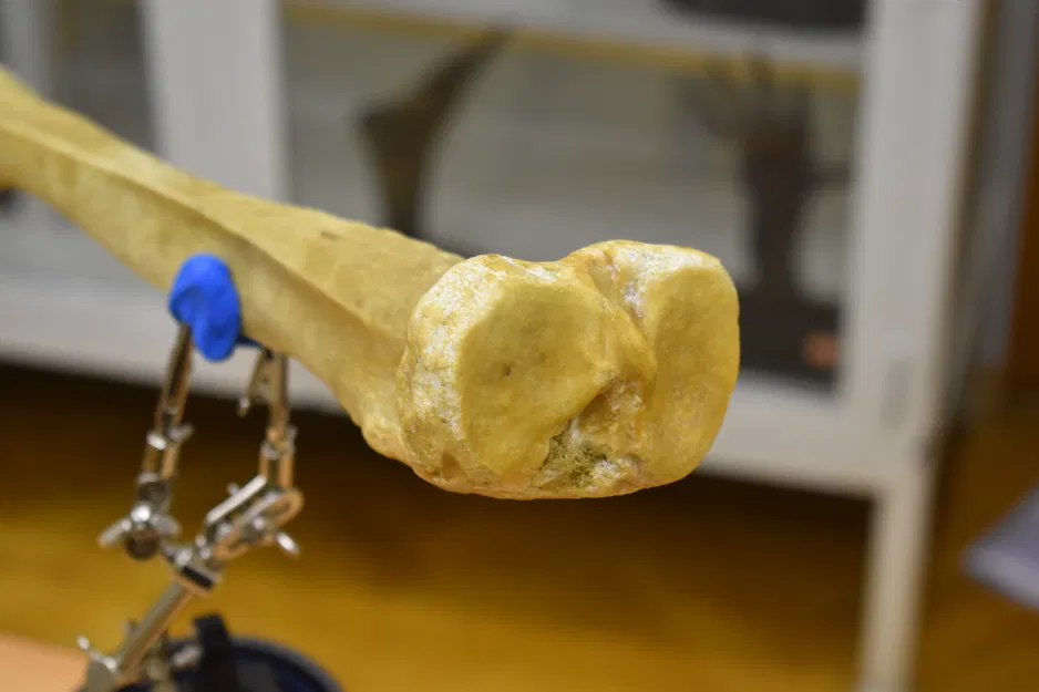 Xương chày - Shinbone Scan - Tibia - Image 3