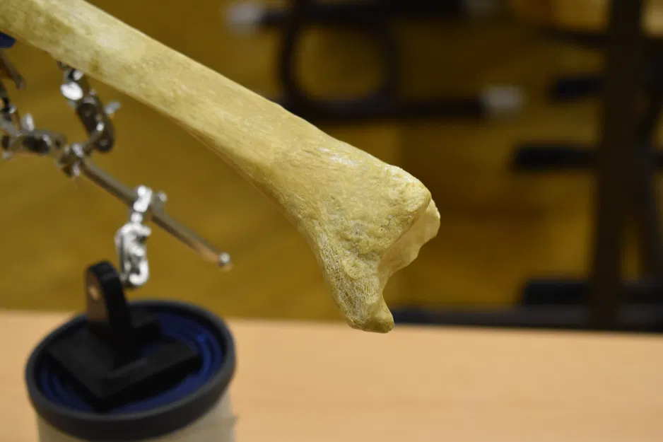 Xương chày - Shinbone Scan - Tibia - Image 4