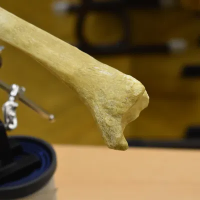 Xương chày - Shinbone Scan - Tibia