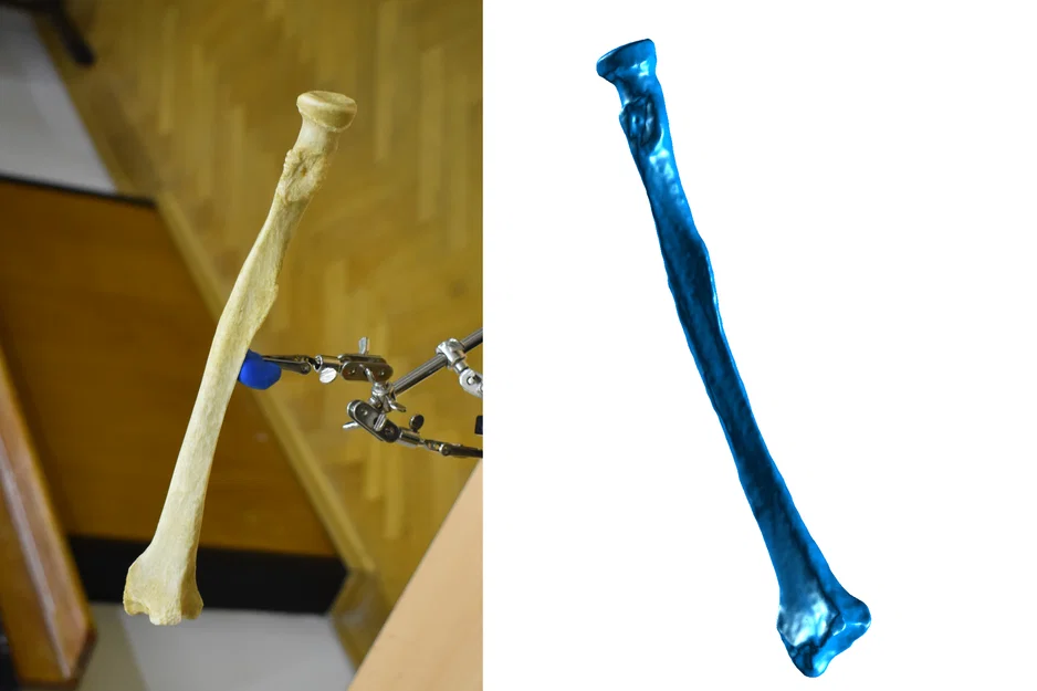 Quét 3D Xương Cẳng Tay - Xương Trụ - Image 1