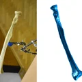 Quét 3D Xương Cẳng Tay - Xương Trụ - Thumbnail 1