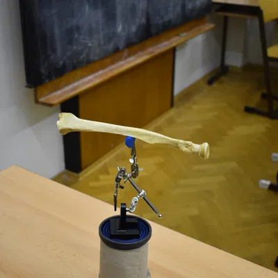 Quét 3D Xương Cẳng Tay - Xương Trụ