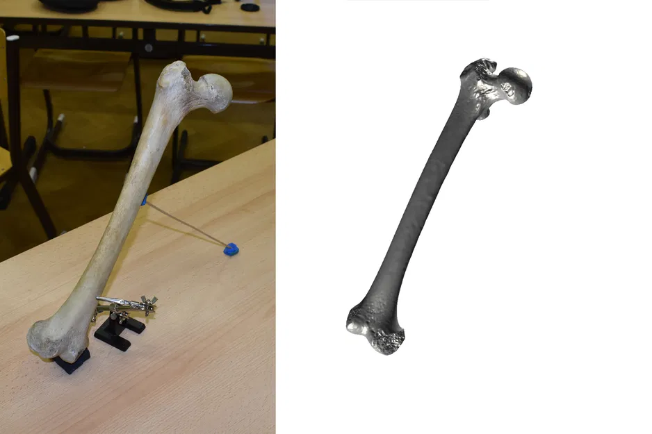 Xương Đùi (Femur) Quét 3D - Image 1