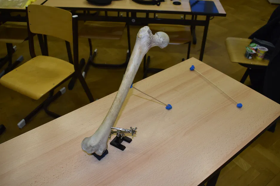 Xương Đùi (Femur) Quét 3D - Image 2