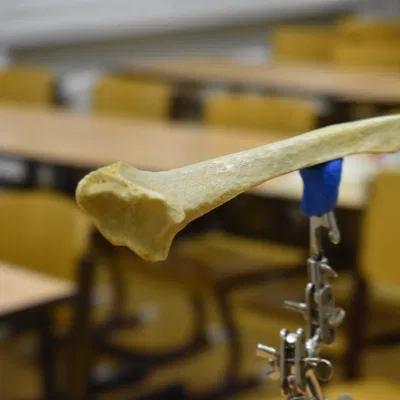 Quét 3D Xương Cẳng Tay - Xương Trụ