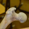 Xương Đùi (Femur) Quét 3D - Thumbnail 3