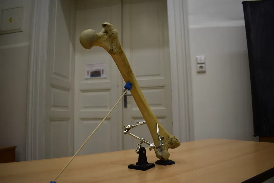 Xương Đùi (Femur) Quét 3D - Image 4