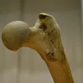 Xương Đùi (Femur) Quét 3D - Thumbnail 5