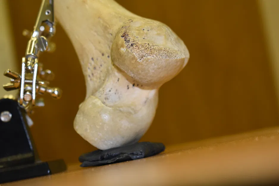 Xương Đùi (Femur) Quét 3D - Image 6