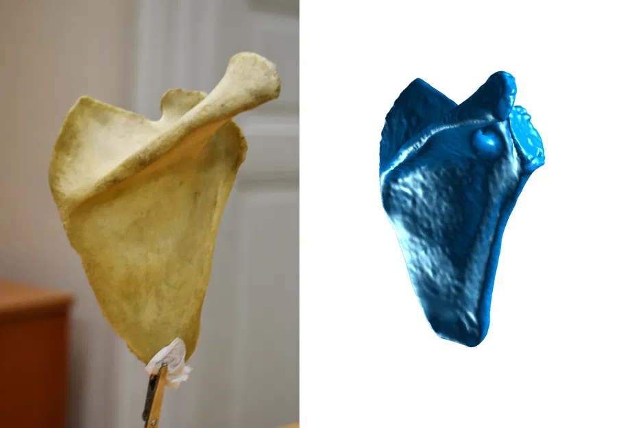 Xương Vai - Scapula (Bản Scan 3D) - Image 1