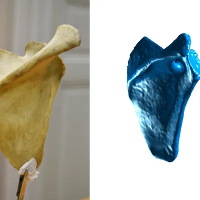 Xương Vai - Scapula (Bản Scan 3D)