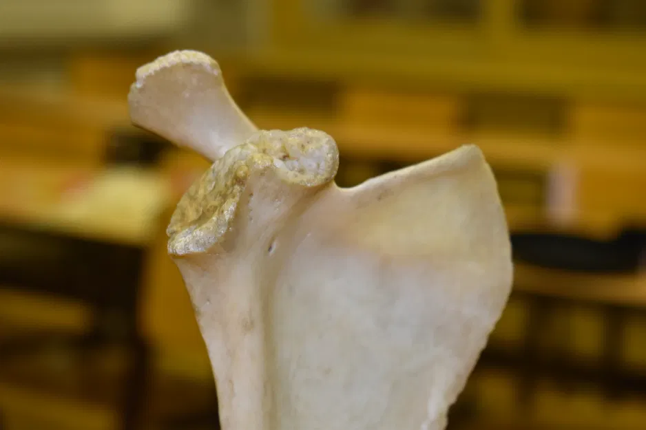 Xương Vai - Scapula (Bản Scan 3D) - Image 2