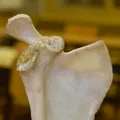Xương Vai - Scapula (Bản Scan 3D) - Thumbnail 2