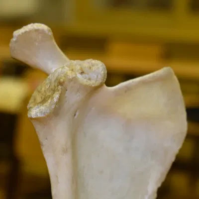 Xương Vai - Scapula (Bản Scan 3D)