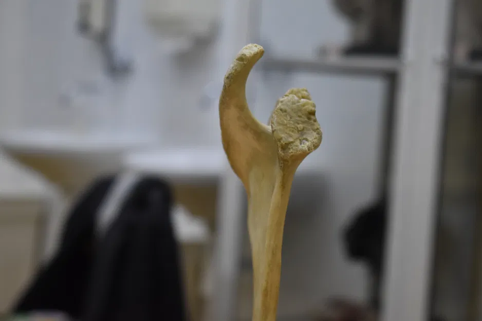 Xương Vai - Scapula (Bản Scan 3D) - Image 4