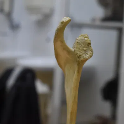 Xương Vai - Scapula (Bản Scan 3D)