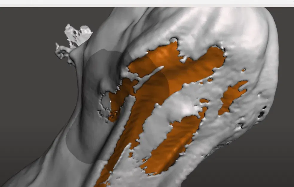 Phục Hồi Đường Viền Chồng Lấp Bằng MeshMixer (3D Scan) - Image 1