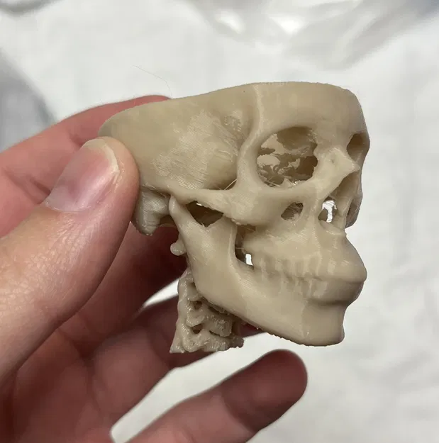 Sọ từ CT Scan 2.0 (có cột sống) - Image 1