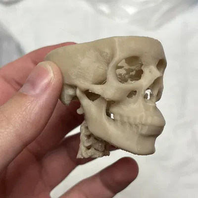 Sọ từ CT Scan 2.0 (có cột sống)