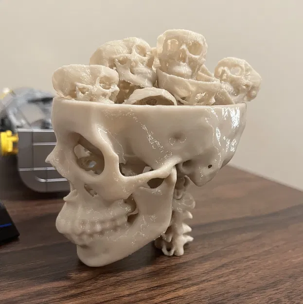 Sọ từ CT Scan 2.0 (có cột sống) - Image 2