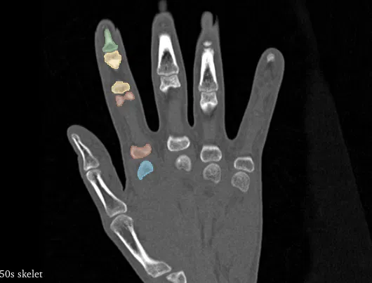 Ngón trỏ linh hoạt - Image 3