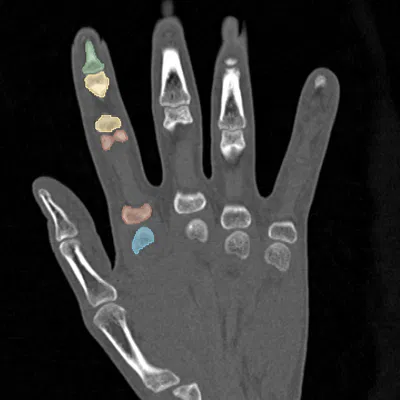 Ngón trỏ linh hoạt