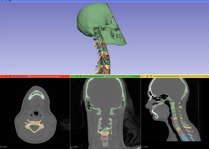 Xương Cổ Sống Linh Hoạt - Image 3