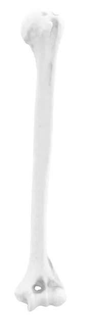 Xương Tay Trên Trái (Humerus Left) - Image 4