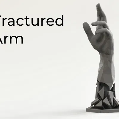 Cánh Tay Gãy