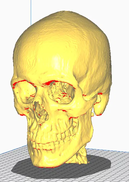 Mô hình CT Scan Hộp Sọ Người - Image 1