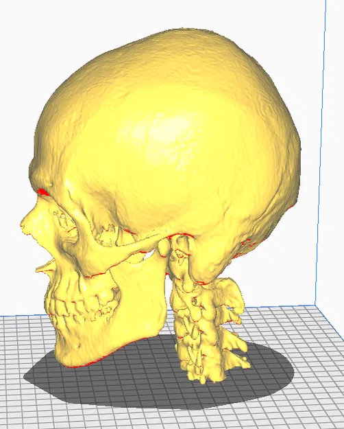 Mô hình CT Scan Hộp Sọ Người - Image 2