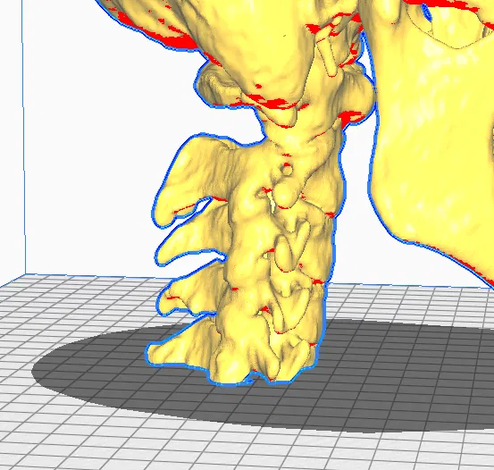 Mô hình CT Scan Hộp Sọ Người - Image 3