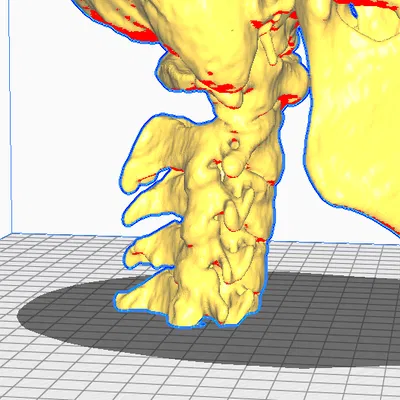 Mô hình CT Scan Hộp Sọ Người