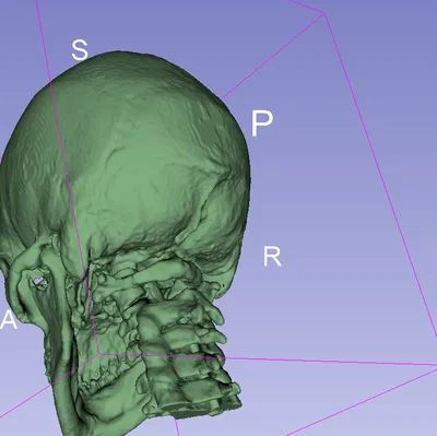 Mô hình CT Scan Hộp Sọ Người
