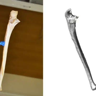 Xương Cẳng Tay - Xương Trụ (Kết quả Scan 3D)