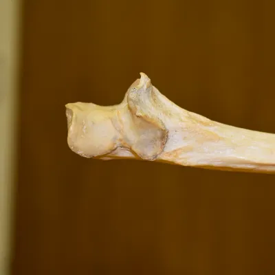 Xương Cẳng Tay - Xương Trụ (Kết quả Scan 3D)