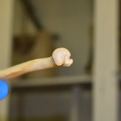 Xương Cẳng Tay - Xương Trụ (Kết quả Scan 3D)