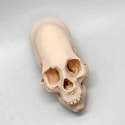 Hộp Sọ Người Peru Nữ Bị Bó Chặt